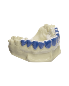 Dreve D4300 BioBleach Soft - 1mm - 20 pieces